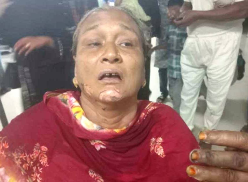 চট্টগ্রাম চলন্ত অটোরিকশায় ‘পেট্রোল বো*মা’ নিক্ষেপ, দুই যাত্রী দগ্ধ