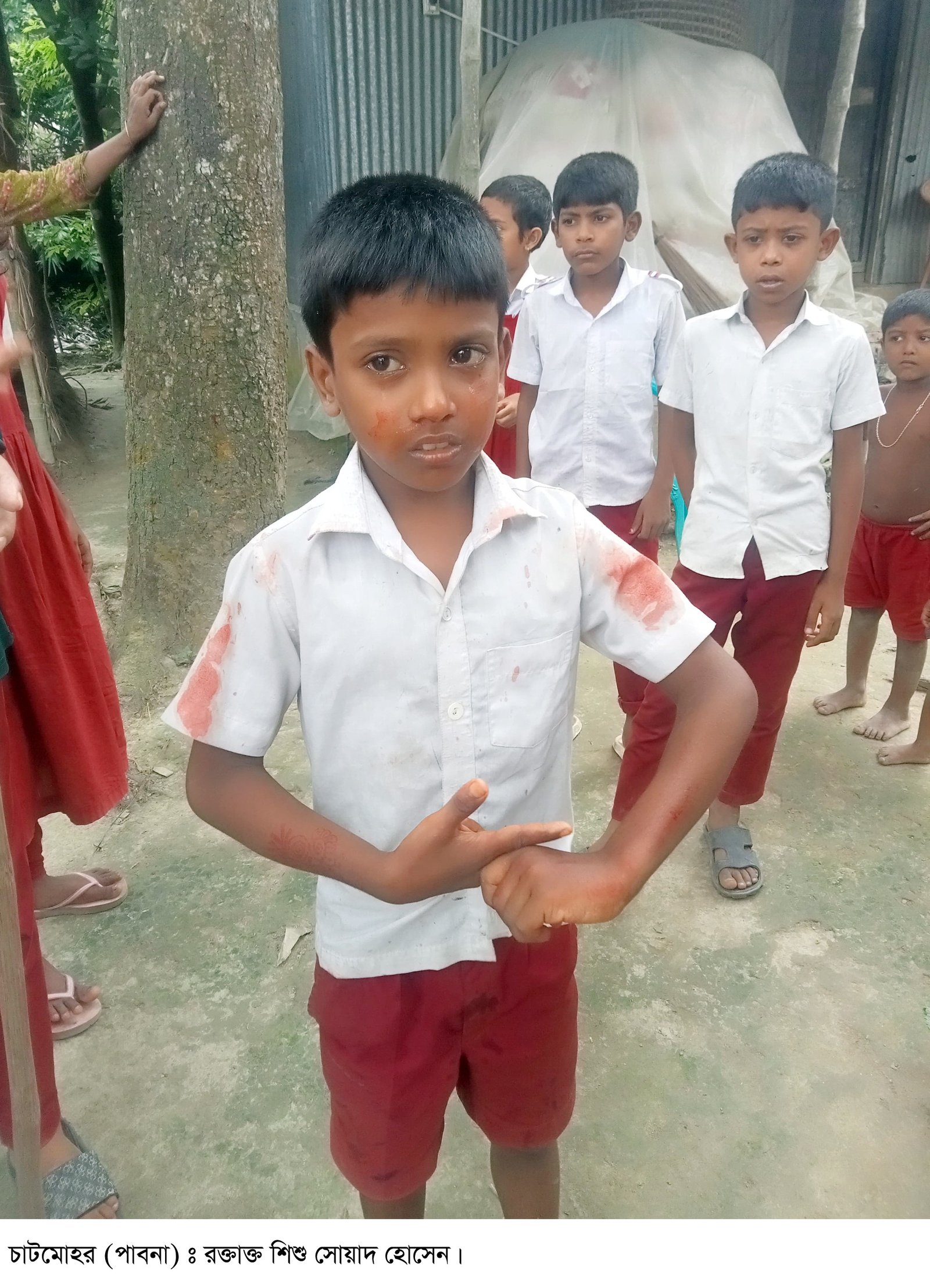 তুচ্ছ ঘটনায় শিশু শিক্ষার্থীর নাক ফাটালেন সহকারি শিক্ষক
